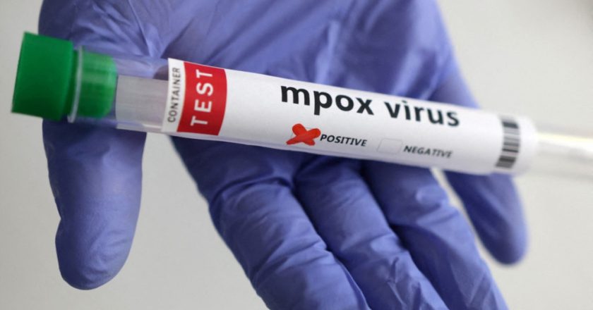 Britain identifies its first case of new mpox variant